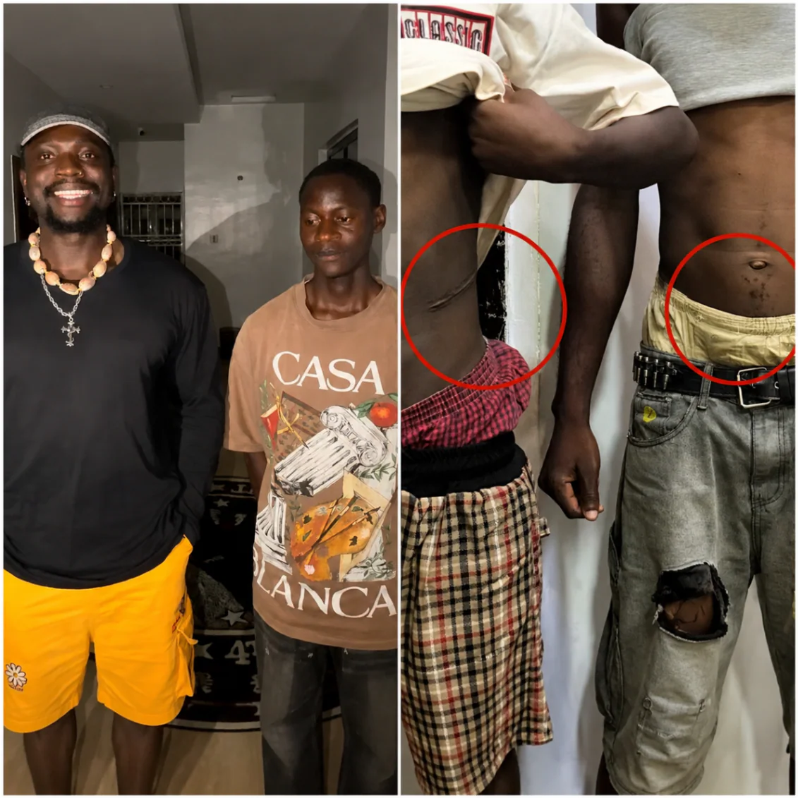 Young Nigerian man who allegedly discovered his kidney was missing seeks help from VeryDarkMan